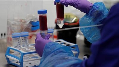 استشاري جهاز هضمي يكشف فصيلة الدم الأقل تضررا من فيروس كورونا | فيديو