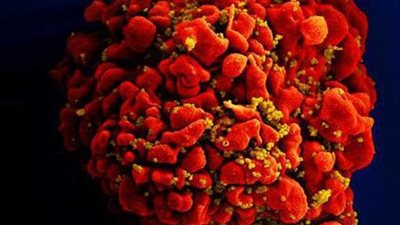 استجواب بالكونجرس حول تفشي فيروس نقص المناعة المكتسبة في ولاية أمريكية