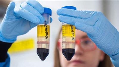 دراسة صادمة: جائحة جديدة أشد فتكا مرتبطة بكورونا ستعصف بالعالم