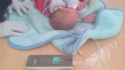 فحص 7266 طفلًا حديث الولادة بالمنيا ضمن مبادرة السمعيات