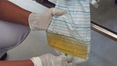 ما حكم صلاة المريض الذي يحمل نجاسة في كيس؟.. دار الإفتاء تجيب