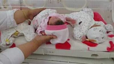 بالحضانة وحالتهن مستقرة.. ولادة قيصرية لخمسة توائم بنات في الجزائر