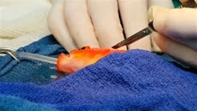 بالفيديو والصور.. إزالة ورم سرطاني من رأس سمكة