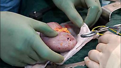 النيابة: حبس زوج سرق كلية زوجته وباعها بعد انتهاء استجوابه