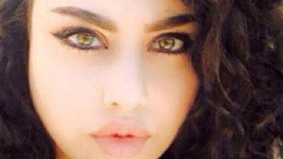 بالصور.. حسناء اللاذقية رفضت الزواج من بلطجي فأطلق عليها رصاصة بالرأس