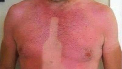 الشمس تغير ملامح أجساد المصطافين (صور)