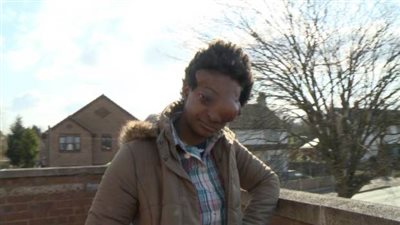 بالصور.. إزالة ورم يزن 2 كيلو جرام من وجه امرأة