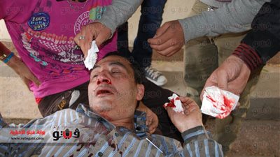 بالصور.. إصابة مراسل 