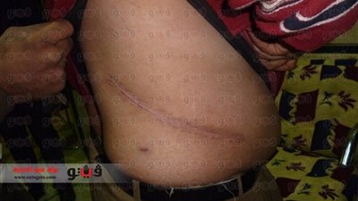 «طارئ» تفضح «مافيا» الأعضاء البشرية