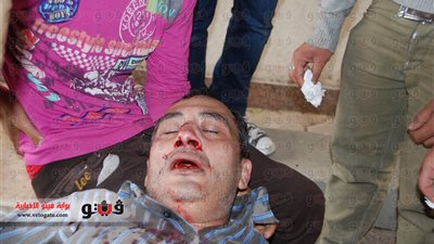 حالتان حرجتان بين صفوف الأقباط إثر إلقاء القنابل المسيلة على الكاتدرائية