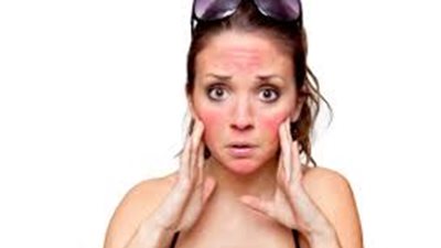 قناع الفراولة للتخلص من آثار حروق الشمس