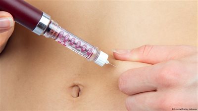 وداعا للحقن.. زراعة خلايا تنتج الإنسولين ذاتيا