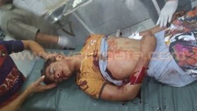 بالصور.. إصابة شاب في انقلاب دراجة بخارية في الشرقية