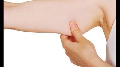 «ترهل الذراعين» الأسباب وطرق الوقاية والعلاج
