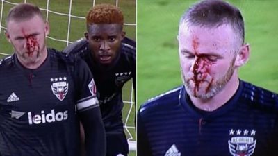 إصابة دموية لـ «روني» في الدوري الأمريكي (صور)