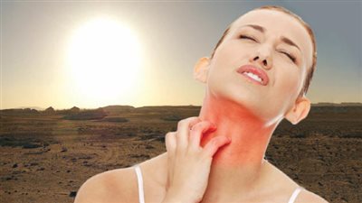 حساسية الشمس.. أعراضها وكيفية مواجهتها