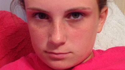 بالصور.. فتاة صلعاء تثير ضجة على «تويتر»