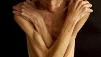 نصائح  للتغلب على النحافة وضعف الشهية