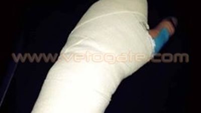 أزمة في حراسة مرمى سموحة بعد إصابة «المهدي»