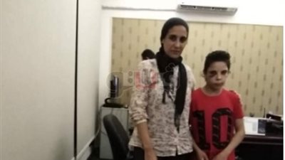 تضامن الإسكندرية تتسلم الطفلة «نور» ضحية التعذيب من قسم مارينا (صور)