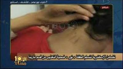 الإبراشى يبرز خبر «فيتو».. التضامن تتسلم الطفلة «نور» ضحية التعذيب (فيديو)