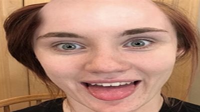 بالصور.. رد فعل صادم لشاب شاهد حبيبته صلعاء