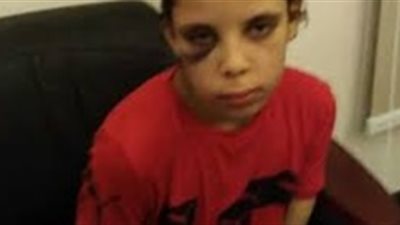 «نور» ضحية تعذيب جديدة.. طفلة باعها والدها بحفنة جنيهات (فيديو)