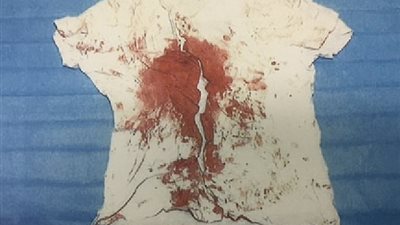 بالصور.. بريطانية تستغيث بعد اغتصابها وطعنها عبر فيس بوك