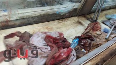 أشلاء ومتعلقات وملابس ملطخة بالدماء.. مشاهد في حادث قطار طوخ الدموى|صور