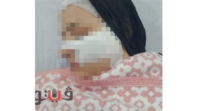 رفضت دفع الإتاوة.. عاطل يمزق وجه ربة منزل بـ