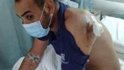 وزير القوى العاملة: المصري المطعون بسكين في الكويت حقوقه محفوظة