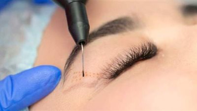 أسباب تجعل النساء تخضع لعملية تجميل الجفون