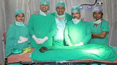 بالصور.. إزالة كتلة شعر من بطن امرأة