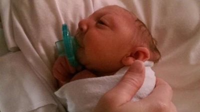 بالصور.. طفل ولد بتشوه في المخ يتحدى الأطباء ويكمل عامه الأول