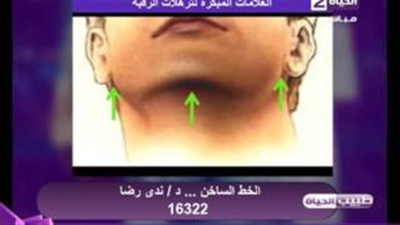 فيتو