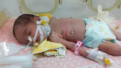 طفل يفقد ذكورته ورضيعة تدفع حياتها ثمنا لإهمال مستشفى أشمون