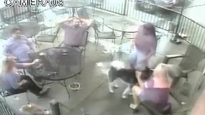 كلب يعض امرأة في وجهها (فيديو)