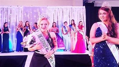 أول مصابة بمتلازمة داون تفوز بمسابقة جمال عالمية (فيديو وصور)