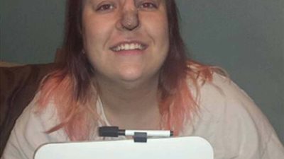 بالصور.. امرأة مصابة بالسرطان تحصل على أنف جديد من فروة رأسها