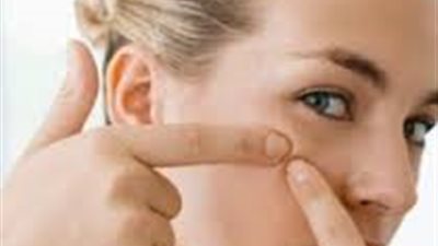 الليمون علاج فعال للقضاء على النمش