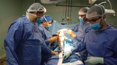 ٤ عمليات تغيير مفاصل ضمن مبادرة القضاء على قوائم الانتظار بالبحيرة