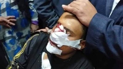 استنفار أمني  بـ