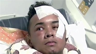 بالفيديو والصور.. رجل ينجو من الموت بعد طعن عينه بسكين اخترقت دماغه