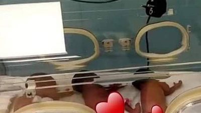 في عملية نادرة.. امرأة تضع تسعة أطفال بدلا من سبعة