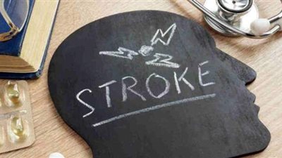 لمرضى السمنة.. أسباب انسداد شريان الرقبة وطرق علاجها