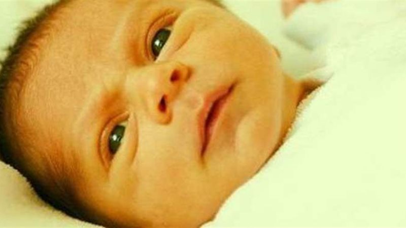 علاج مرض الصفراء
