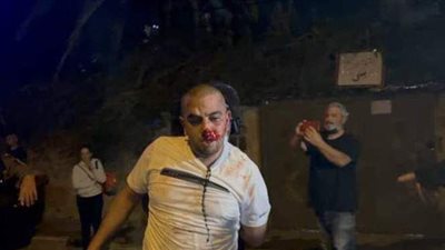 قلوبنا مع الأقصى.. بث مباشر من داخل حي الشيخ جراح