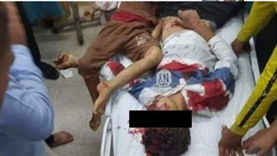 طيران الاحتلال يستهدف 3 أطفال فلسطينيين بقطاع غزة