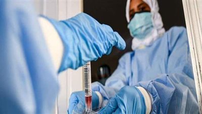 شعبة الأدوية تكشف مخزون مصر من علاج كورونا