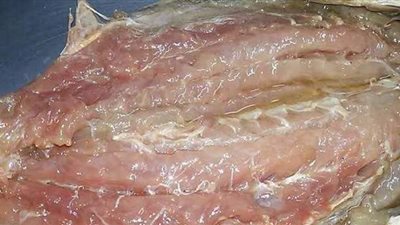 أعراض تؤكد إصابتك بـ تسمم الفسيخ